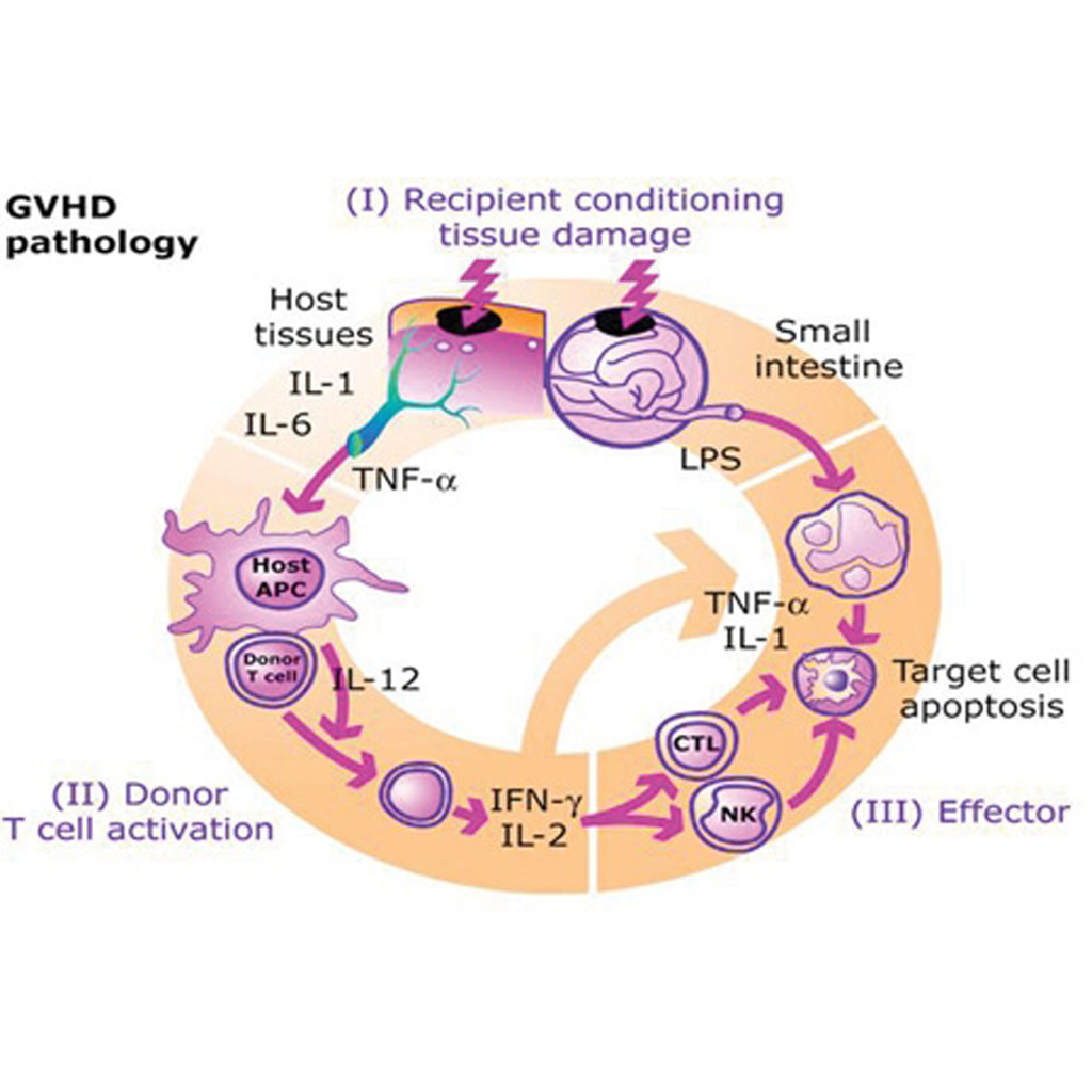 graft-versus-host-disease-gvhd-cgdsociety